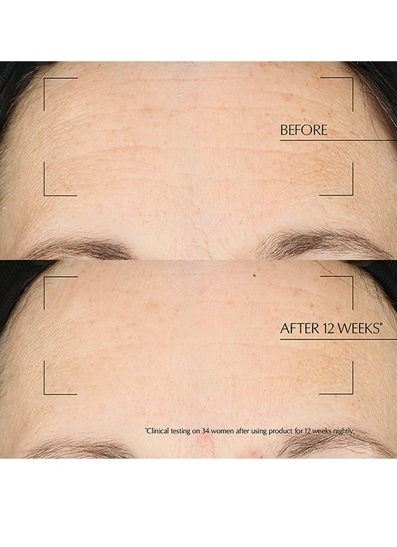 advanced night repair overnight treatment